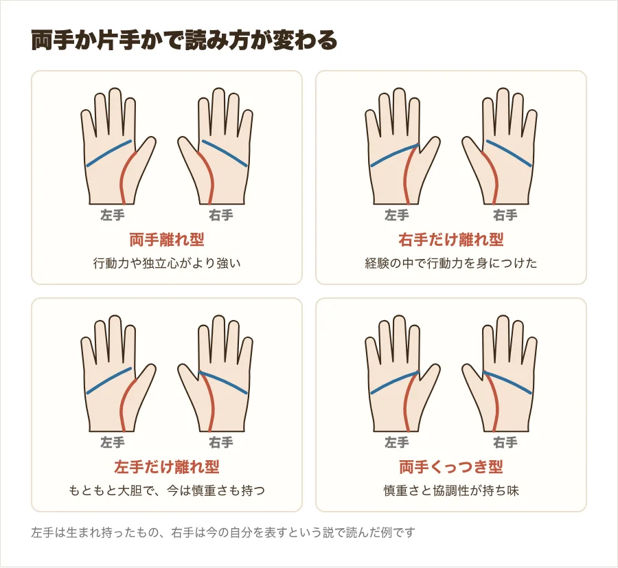 両手離れ型・右手だけ離れ型・左手だけ離れ型・両手くっつき型の4つを、左右の手のひらで比べた図解