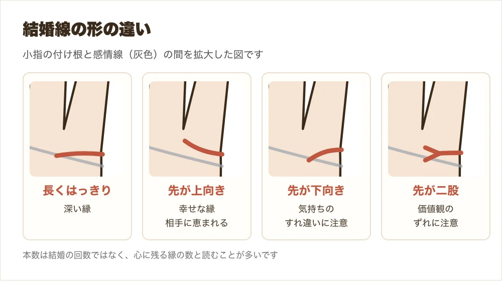 結婚線の長さ・上向き・下向き・二股の違いを並べた図