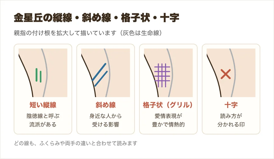 金星丘の縦線・斜め線・格子状(グリル)・十字の違いを比べた図