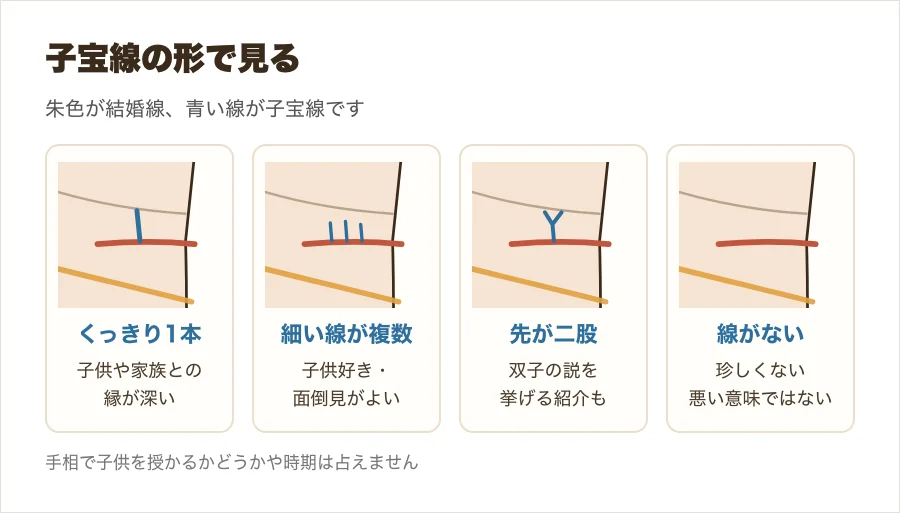 子宝線の形の違いを、くっきり1本・細い線が複数・先が二股・線がないの4つの拡大図で比べた図解
