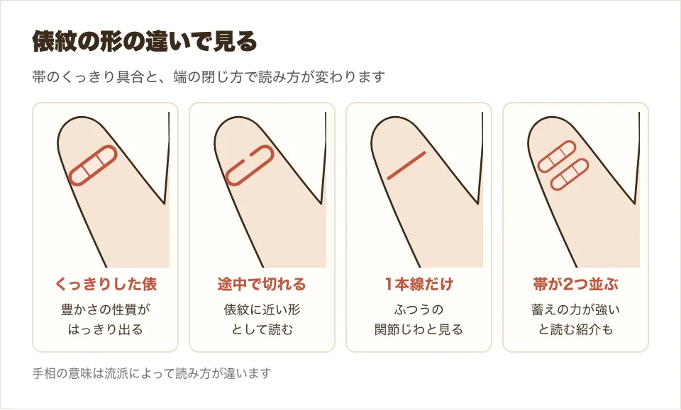 俵紋の形の違い、くっきりした俵・途中で切れる・1本線の関節じわ・帯が2つ並ぶの4つを並べた図解